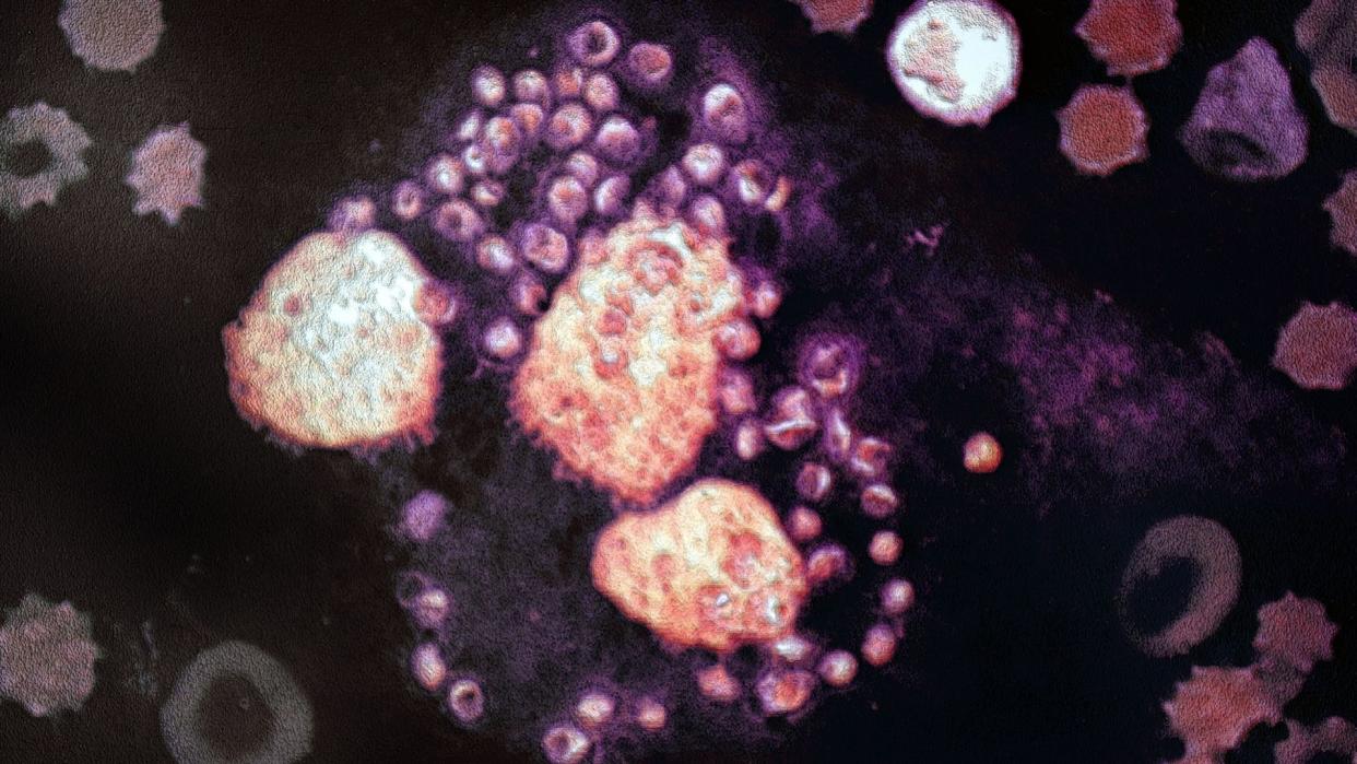  Roughly circular single-cell parasites shown surrounding and attacking several larger cells in a tissue sample. 