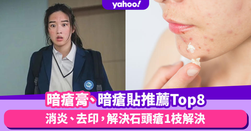 暗瘡膏推薦｜好評暗瘡膏、暗瘡貼推薦Top8！消炎、去印，解決石頭瘡1枝解決