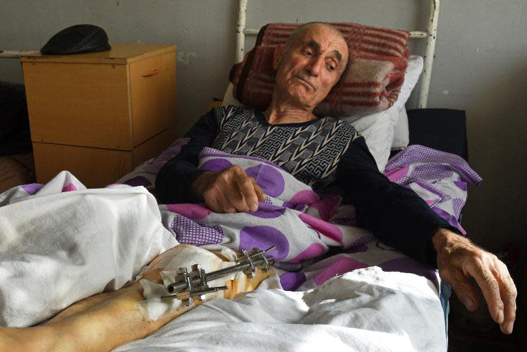 Levon Andreasyan, 85, wounded by Azerbaijani sniper fire in Movses, in Armenia, lies on his hospital bed on February 13, 2015