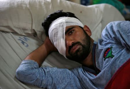 A man who was injured in clashes between Indian police and protesters, rests inside a hospital ward in Srinagar September 21, 2016. Picture taken September 21, 2016. REUTERS/Danish Ismail