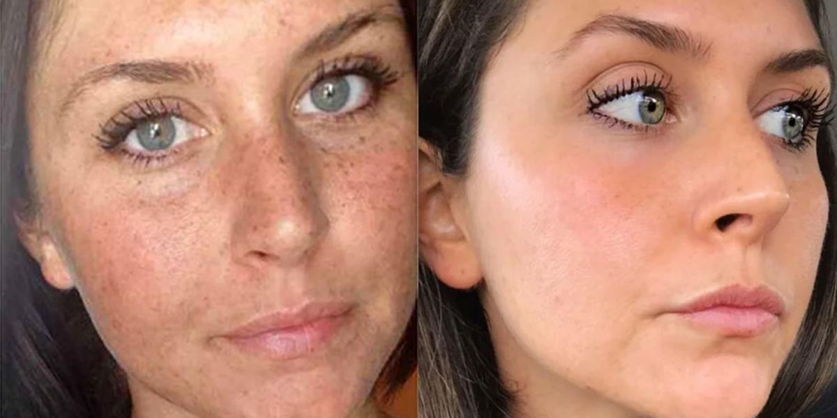 This photo shows what 28 years of sun damage does to your face