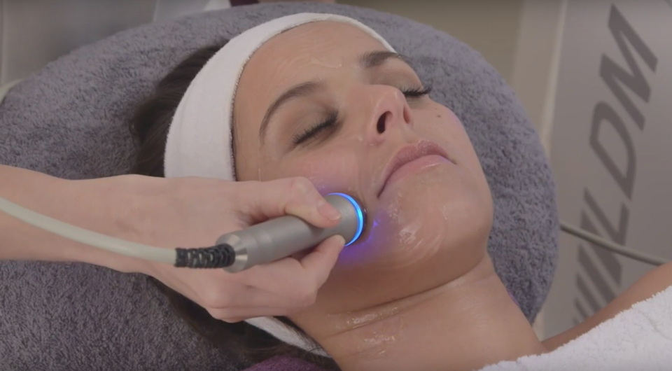 LDM, a dual-frequency laser technology treatment. (Photo: Ageless Medical)