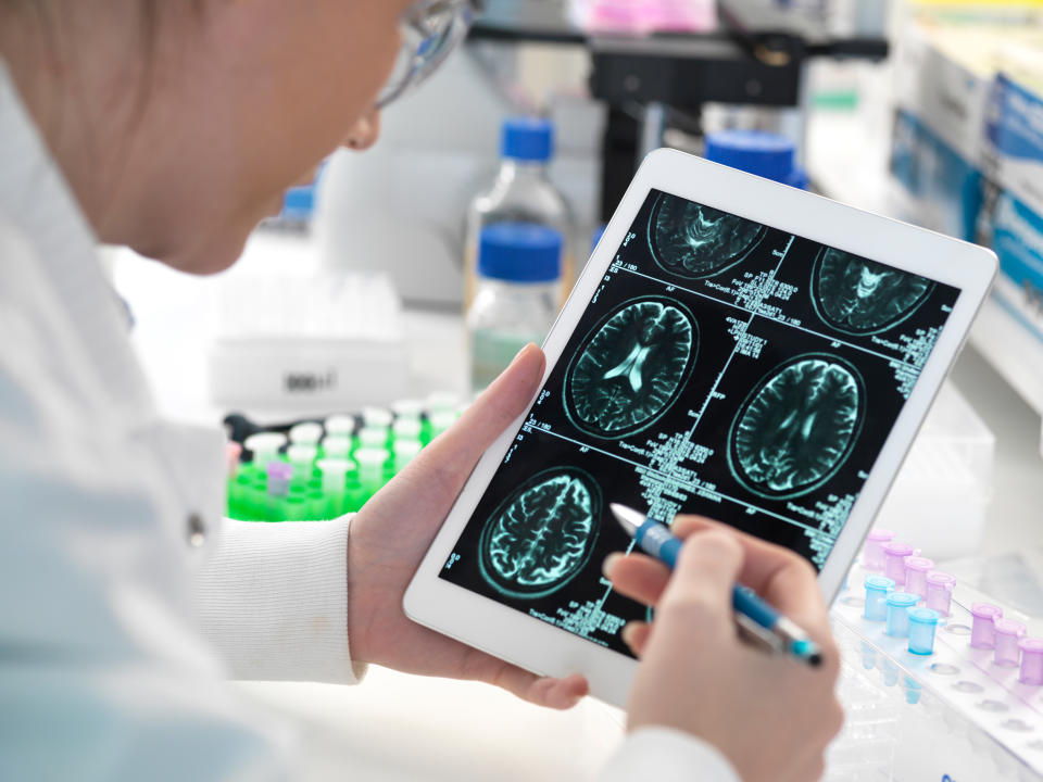 A doctor pores over a tablet showing brain scans. 