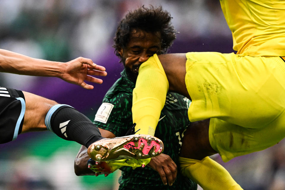 <p>Percuté violemment par le genou de son gardien en plein visage, lors du match contre l'Argentine le 22 novembre, le Saoudien Yasser Al-Shahrani a déclaré forfait pour le reste du Mondial. Et pour cause, le défenseur a été victime d'une commotion cérébrale, d'une fracture de la mâchoire et a subi des dommages internes à la poitrine et à l’abdomen ainsi qu’une hémorragie interne. (Photo Kirill KUDRYAVTSEV / AFP)</p> 