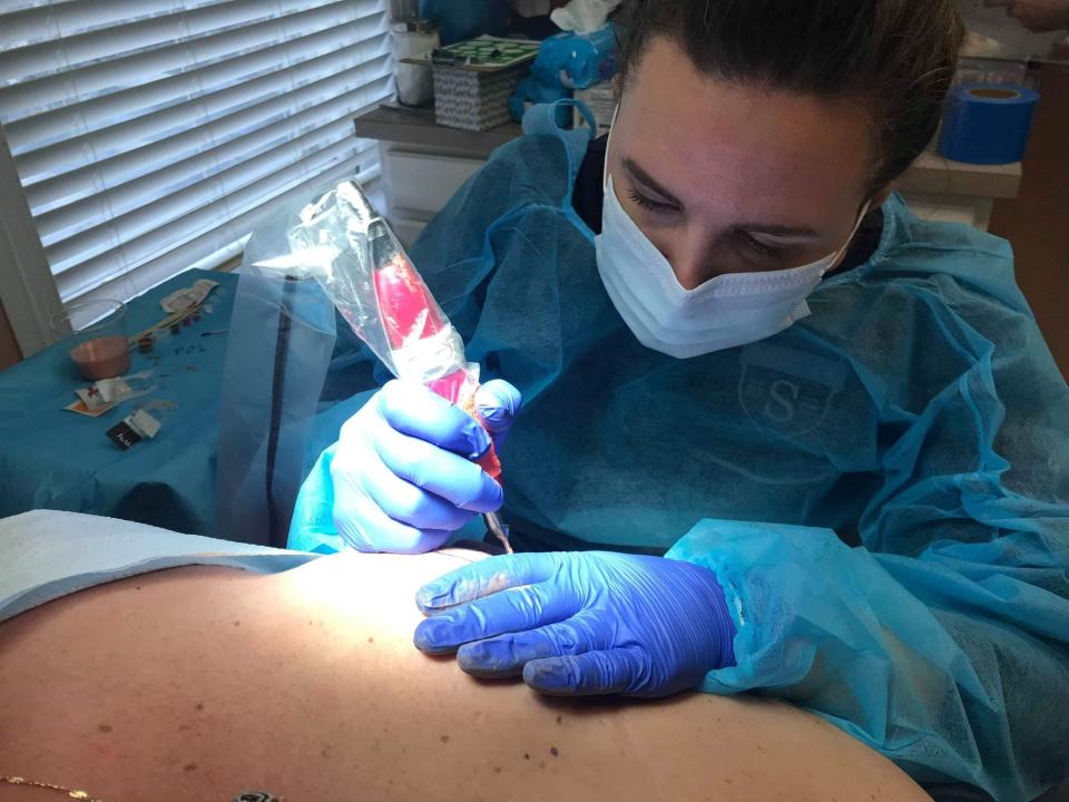 Tattoo artist Jenean LaCorte performs a medical tattoo