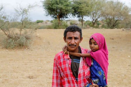 Hussein Abdu, 40, father of ten-year-old Afaf Hussein who is malnourished, carries her as he herds sheep near their village of al-Jaraib in northwestern province of Hajjah, Yemen, February 19, 2019. Afaf, who now weighs around 11 kg and is described by her doctor as "skin and bones", has been left acutely malnourished by a limited diet during her growing years and suffering from hepatitis, likely caused by infected water. She left school two years ago because she got too weak. "Before the war we managed to get food because prices were acceptable and there was work ... Now they have increased significantly and we rely on yogurt and bread for nutrition," said Abdu. REUTERS/Khaled Abdullah