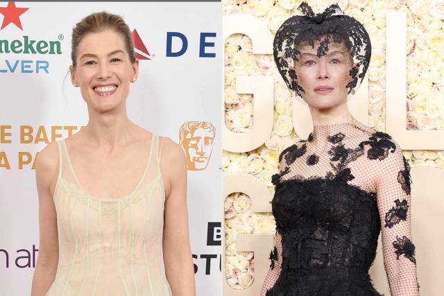 Rosamund Pike Shares Update on Skiing Injury That 'Messed Up' Her Face  Prior to the Golden Globes (Exclusive)