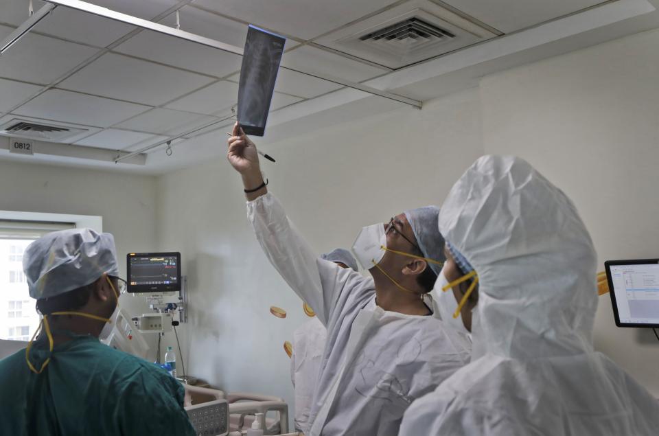 Dr. Kedar Toraskar, center, head of critical care, checks the X-ray of a COVID-19 patient in the ICU ward where he oversees at the Mumbai Central Wockhardt Hospital in Mumbai, India, June 5, 2021. The recent coronavirus surge in India affected young people on a scale his team of critical care doctors hadn’t previously seen. Toraskar and his team of ICU doctors are still drained from the incredibly challenging last few months. (AP Photo/Rajanish Kakade)