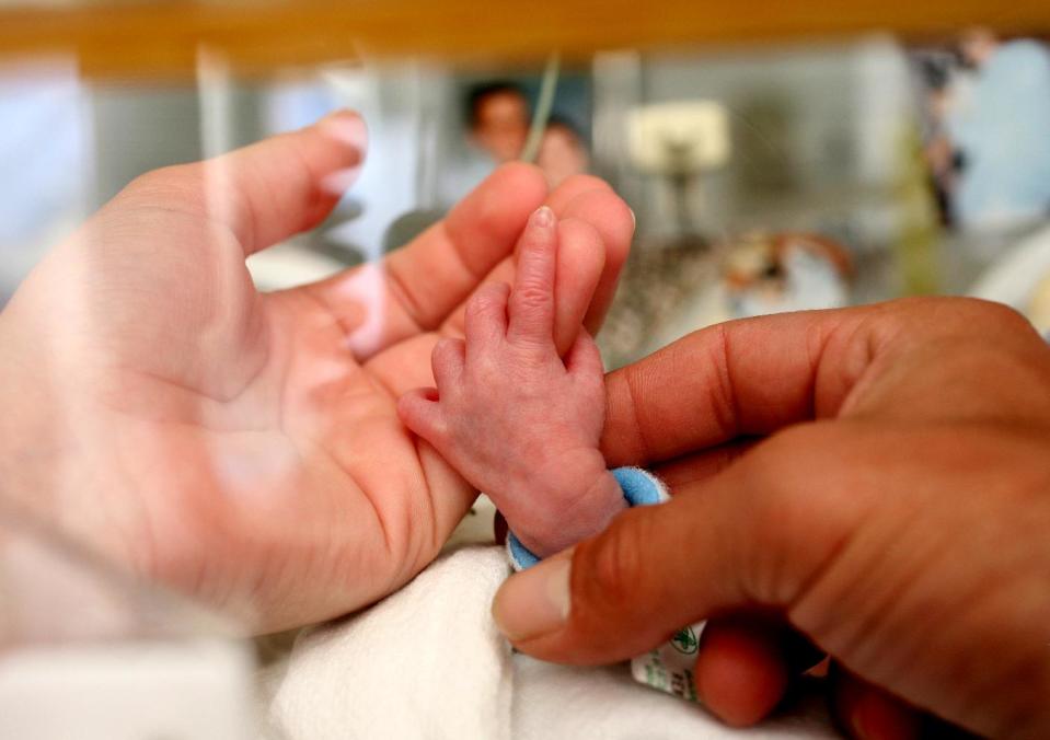 This July 25, 2006 handout photo provided by the March of Dimes Foundation shows a baby in the Neonatal Intensive Care Unit (NICU) at the Albany Medical Center in Albany, N.Y. About 15 million premature babies are born every year _ more than 1 in 10 of the world’s births and a bigger problem than previously believed, according to the first country-by-country estimates of this obstetric epidemic. The startling toll: 1.1 million of these fragile newborns die as a result, and even those who survive can suffer lifelong disabilities. (AP Photo/Jennifer Coate, March of Dimes Foundation)