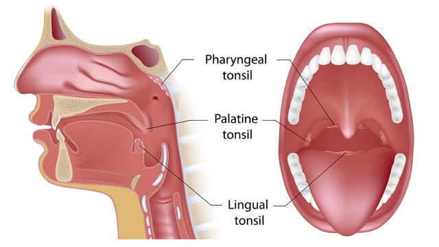 bumps on back of throat