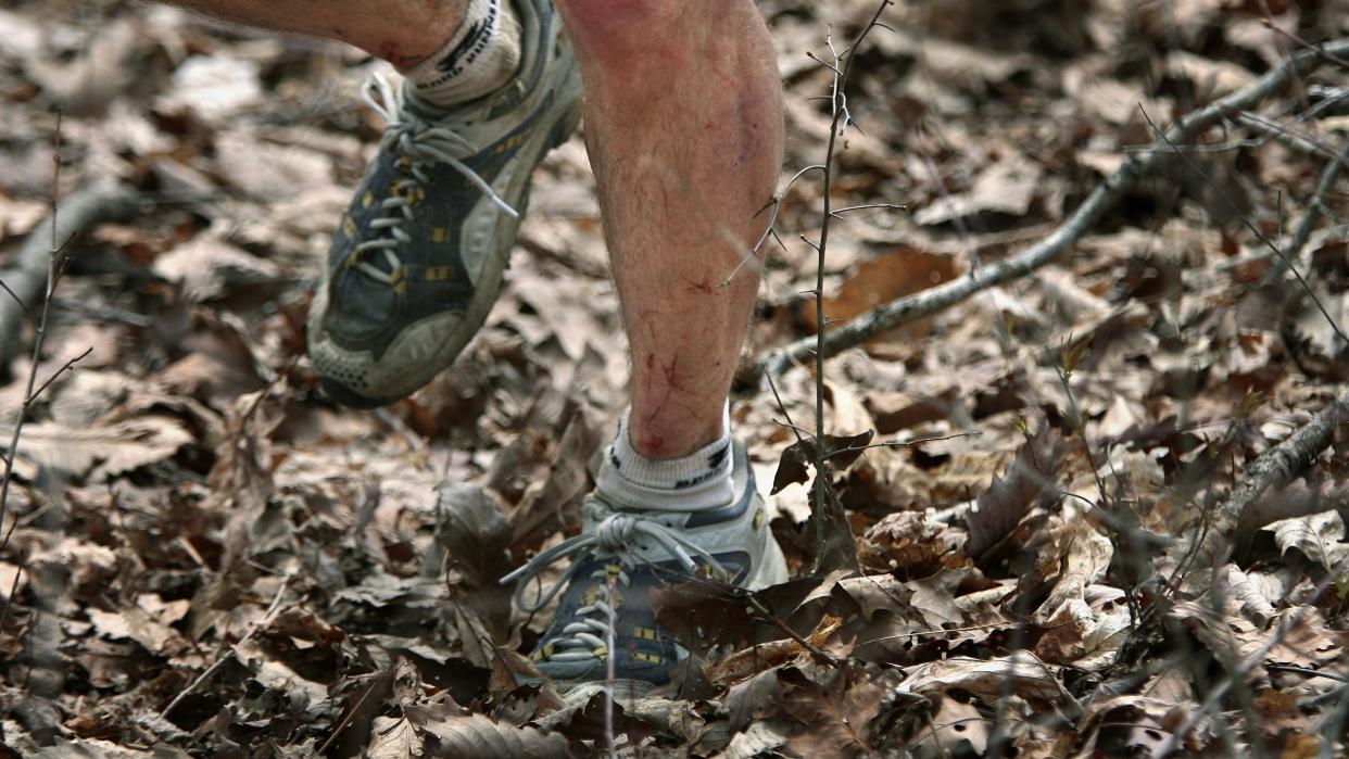  The Barkley Marathon. Here, the legs of Jim Nelson are cut and bleeding from the thorns of the sawbreyer bushes throughout the course. 