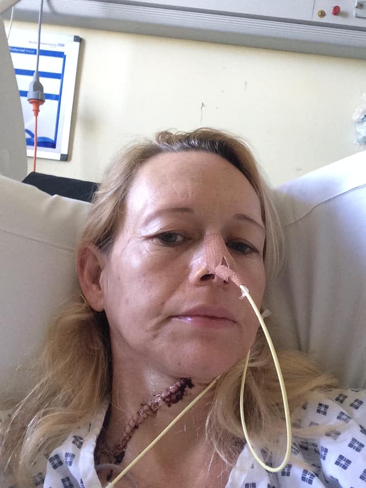 Karen following surgery (Handout/PA)