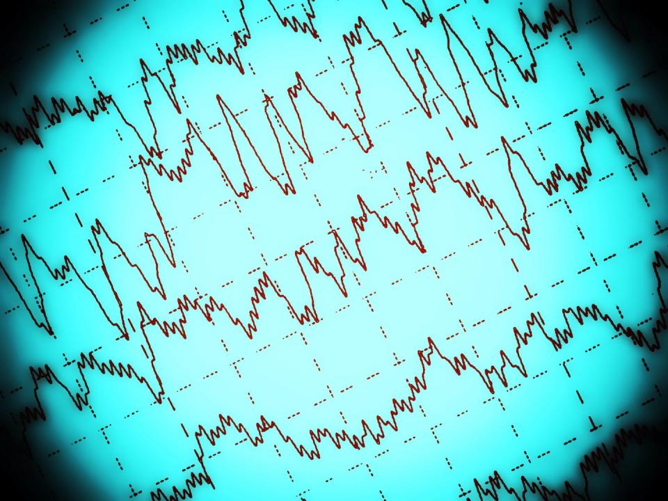 <a href="https://www.shutterstock.com/es/image-illustration/brain-wave-on-electroencephalogram-eeg-epilepsy-286773161" rel="nofollow noopener" target="_blank" data-ylk="slk:Shutterstock / xpixel;elm:context_link;itc:0;sec:content-canvas" class="link ">Shutterstock / xpixel</a>