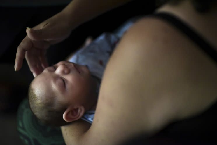 Two-month-old Inti Perez, diagnosed with microcephaly linked to the mosquito-borne Zika virus, is cradled by his mother, in Bayamon, Puerto Rico. (Photo: Carlos Giusti/AP)