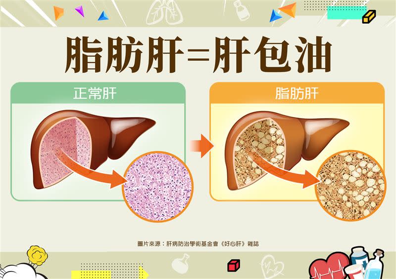 葉秉威醫師警告，台灣恐高達600萬人深受其害，萬病之源就是「脂肪肝」。（圖／圖片來源：肝病防治學術基金會《好心肝》）
