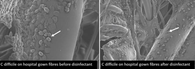 C Diff on hospital gowns before and after disinfectant 