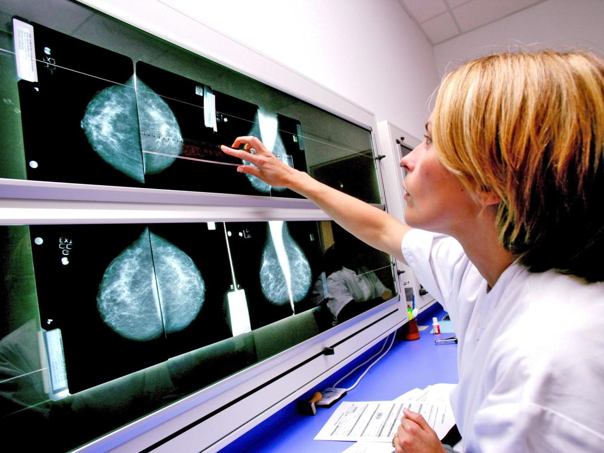 A radiologist examines mammograms on a lightbox: Rex Features