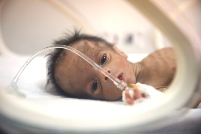 A premature baby is seen in an incubator at a maternity hospital in Idlib