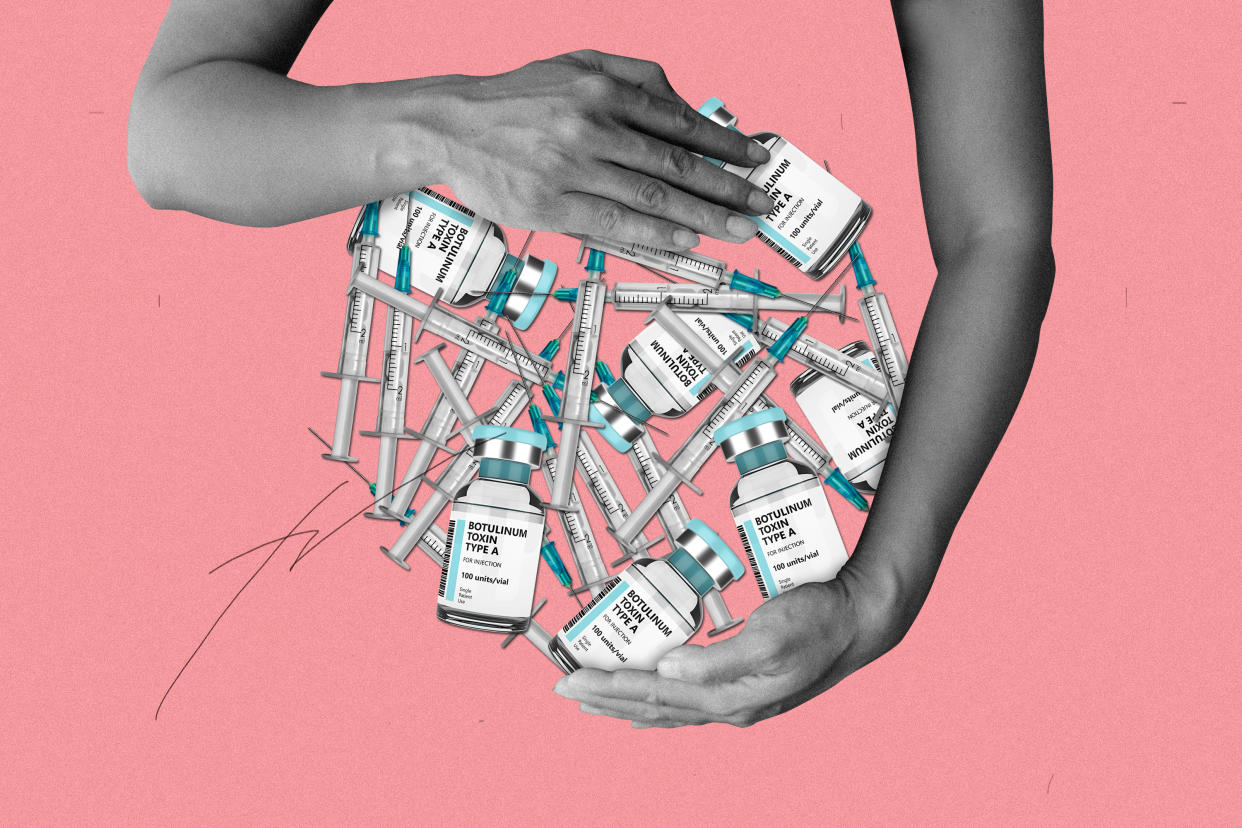 A photo illustration shows two female arms clutching bottles of Botox and syringes as if they were a baby bump.