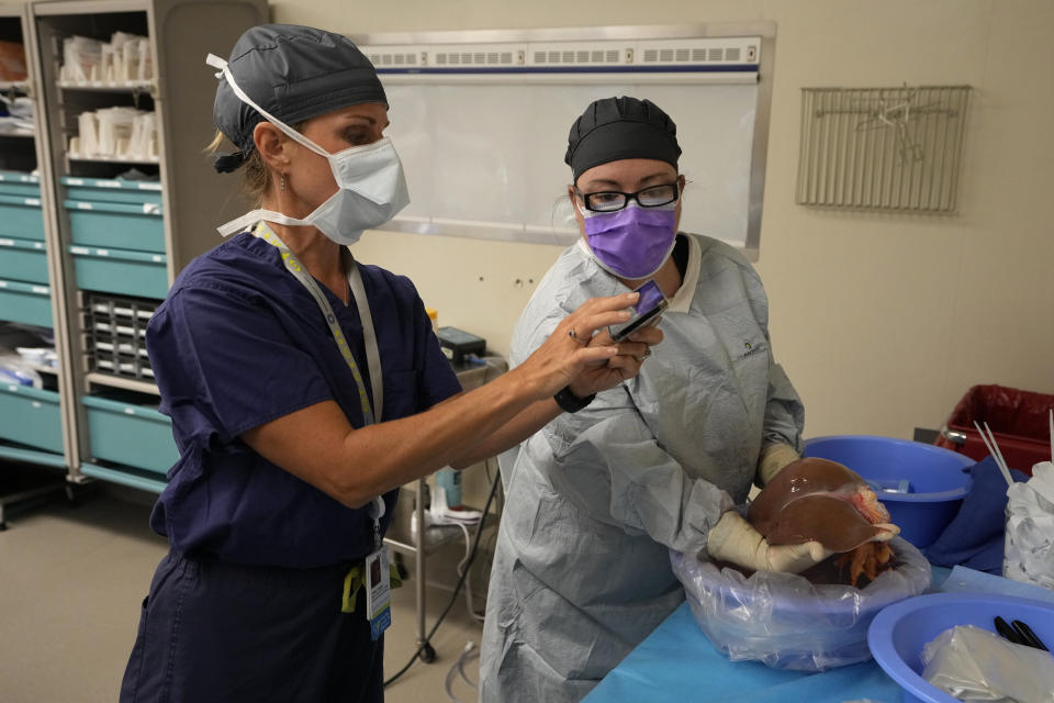 Deana Clapper, associate executive director of Tennessee Donor Services, left, photographs a liver after it was removed from an organ donor on June 15, 2023, in Jackson, Tenn. The photograph and other information is sent on to the transplant team of the waiting organ recipient. Cancer was later found in the donor’s lungs so the liver couldn’t be used. (AP Photo/Mark Humphrey)