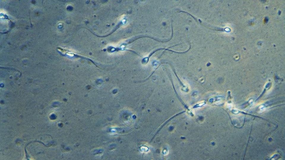 Espermatozoides bajo el microscopio
