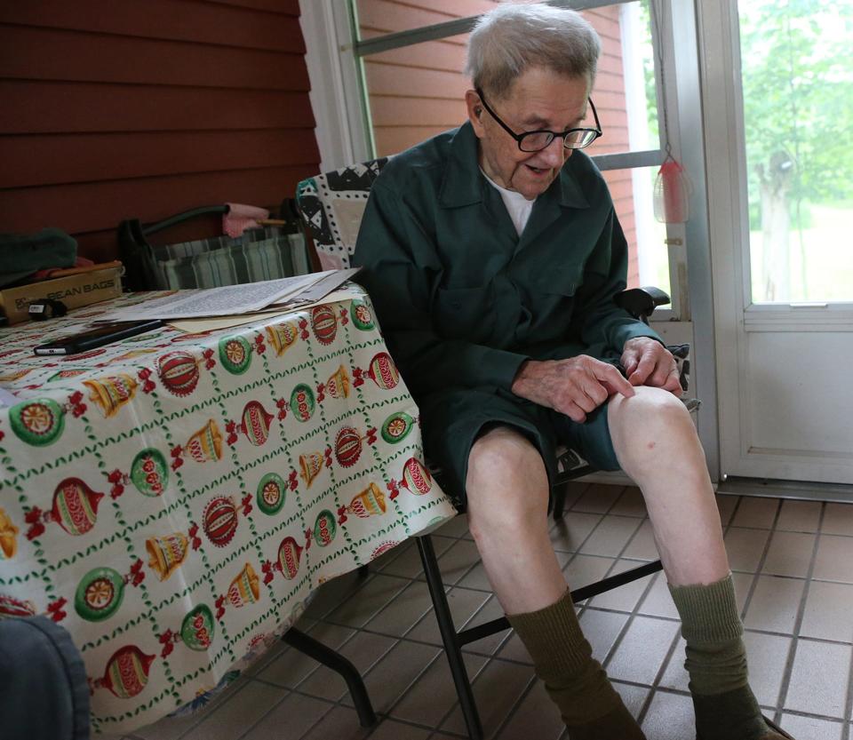 Tonie Darvid shows where a piece of shrapnel, which he got when running from Germans during WWII, is still in his knee on the porch of his Portsmouth home on July 15, 2021.