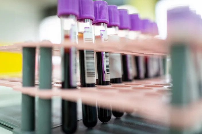 Blood samples in a laboratory