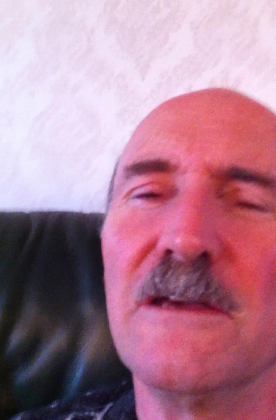 Robert in March 2015 unable to open his eyes in the video he sent to his doctor (Collect/PA Real Life)