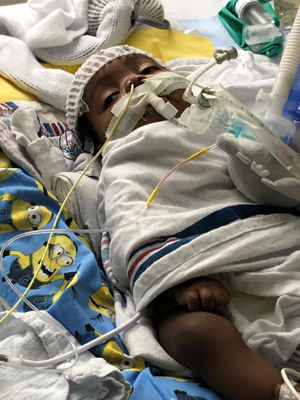 Dairess Fuller Jr., when under the care of LaMeka Lowe, in the hospital when he was diagnosed with subglottic stenosis (undeveloped airway) on December 2, 2018.