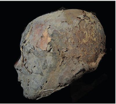 Cabeza momificada de doña Leonor de Castilla. <a href="https://www.researchgate.net/publication/353105462_Natural_mummifications_in_Castille_Leon_Spain" rel="nofollow noopener" target="_blank" data-ylk="slk:Pastor et al. 2021. Natural mummifications in Castile & Leon (Spain). European Journal of Anatomy 25: 221–32.;elm:context_link;itc:0;sec:content-canvas" class="link ">Pastor et al. 2021. Natural mummifications in Castile & Leon (Spain). European Journal of Anatomy 25: 221–32.</a>, <a href="http://creativecommons.org/licenses/by/4.0/" rel="nofollow noopener" target="_blank" data-ylk="slk:CC BY;elm:context_link;itc:0;sec:content-canvas" class="link ">CC BY</a>