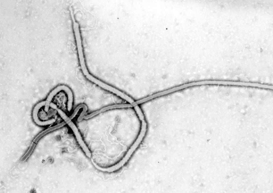 Microscopía electrónica de un virión del Ebolavirus | Wikicommons