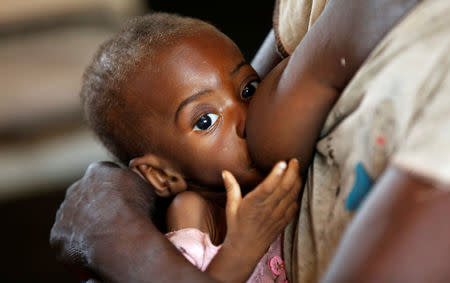 A severely acute malnourished and internally displaced Congolese child is breastfed as she waits to receive medical attention at the Tshiamala general referral hospital of Mwene Ditu in Kasai Oriental Province in the Democratic Republic of Congo, March 15, 2018. Picture taken March 15, 2018. REUTERS/Thomas Mukoya