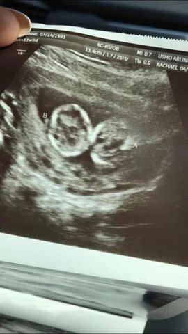 <p>Darionne Burley/ Facebook</p> Darionne Burley's ultrascan, depicting her twin boys.