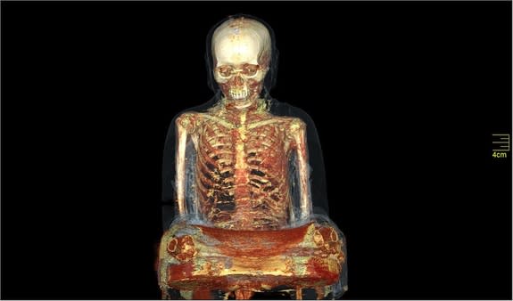 Otra imagen de la momia del monje obtenida mediante resonancia magnética.
