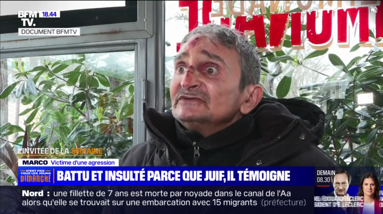 Marco, 62 ans, a été agressé vendredi 1er mars à Paris alors qu’il sortait d’une synagogue.
