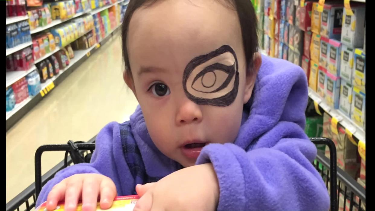 Dad Makes Adorable Custom Eye Patches For His Daughter