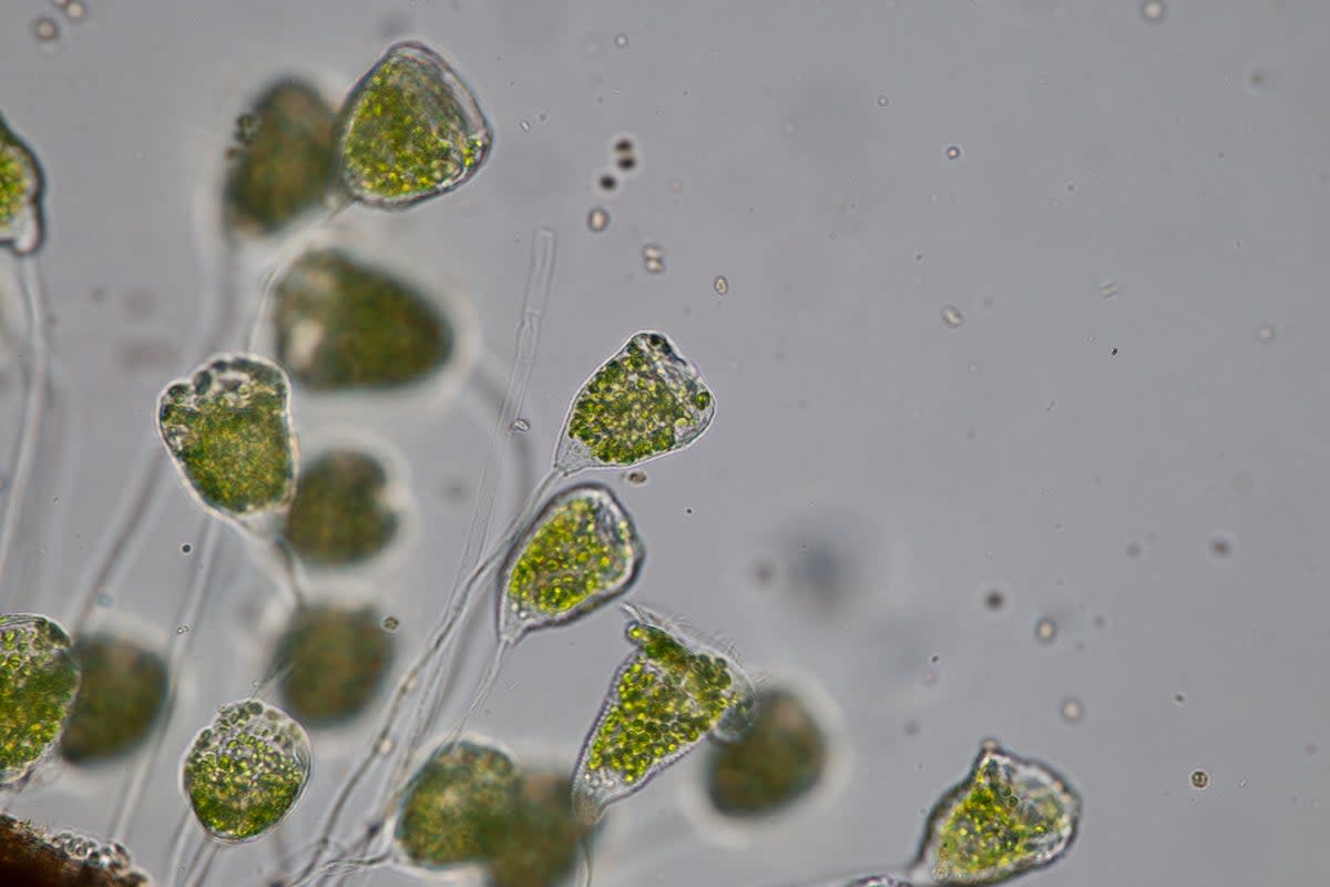 A stock image of microscopic organisms in waste water. The research team located the previously undiscovered branch of life in oceans around the world (Getty)