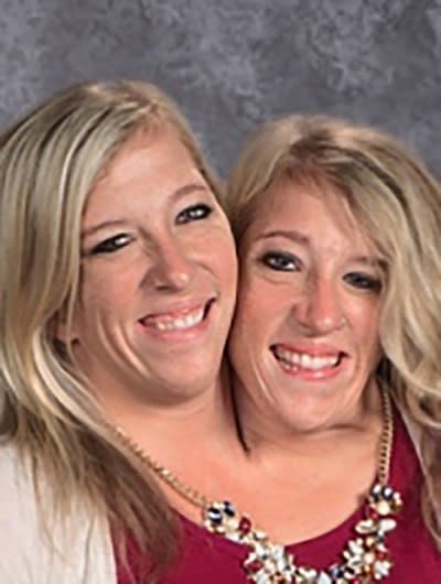 Hensel Twins: Inside the Lives of Abby and Brittany Hensel