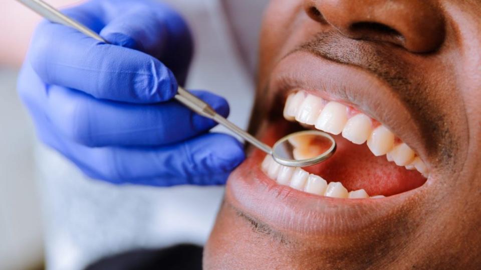 The Perry Family Free Dental Clinic, which opened on Dec. 7 inside the Boys and Girls Club in Fitchburg, Wisconsin, will provide free dental services to Black men. (Photo: Adobe Stock)