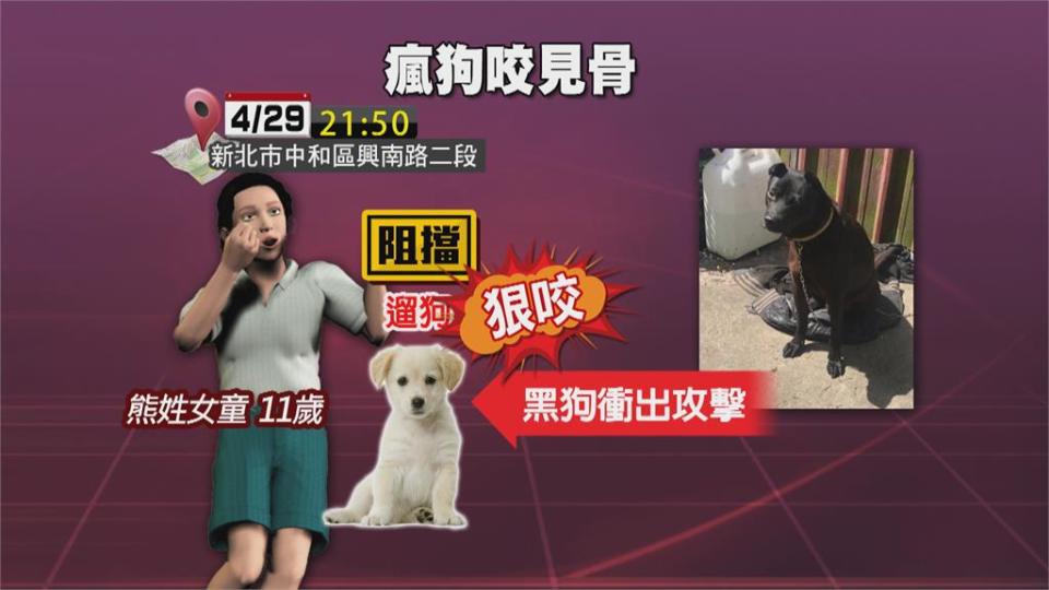 中和驚傳女童遭狗咬見骨　 母怒控飼主態度惡劣