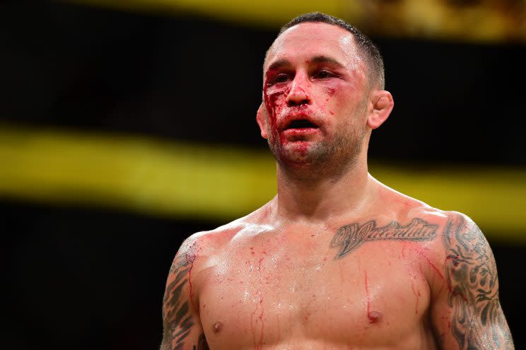 Frankie Edgar's face was mangled in a loss to Jose Aldo at UFC 200 in July. (Getty Images)