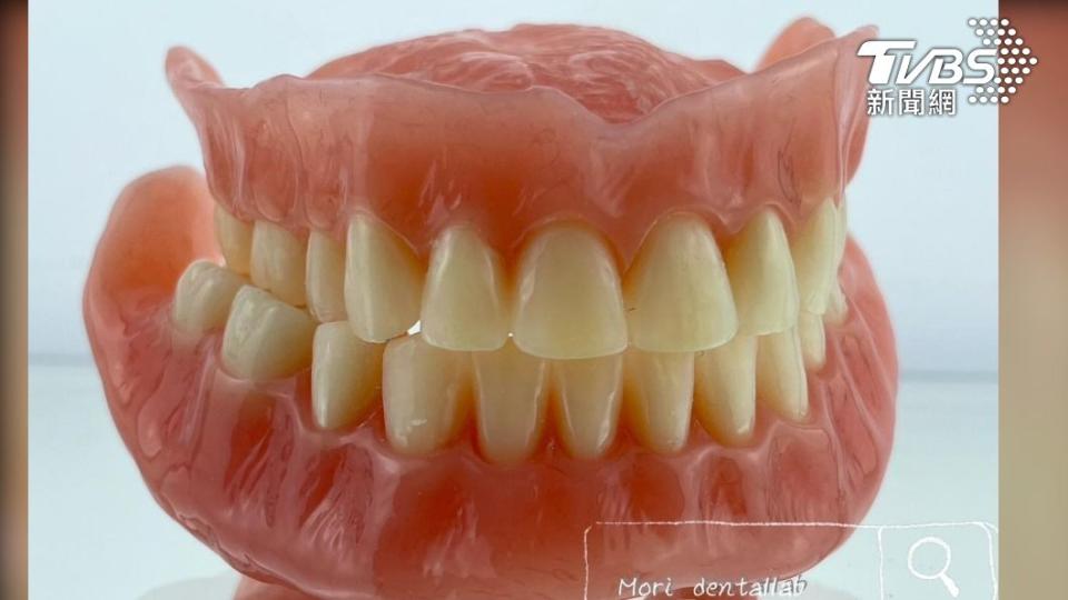 BPS吸附性假牙 類真空效果穩固美觀(圖/雲天牙醫診所)