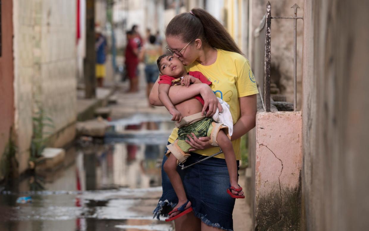 Children affected by the 2015-16 Zika virus outbreak, Recife, Brazil