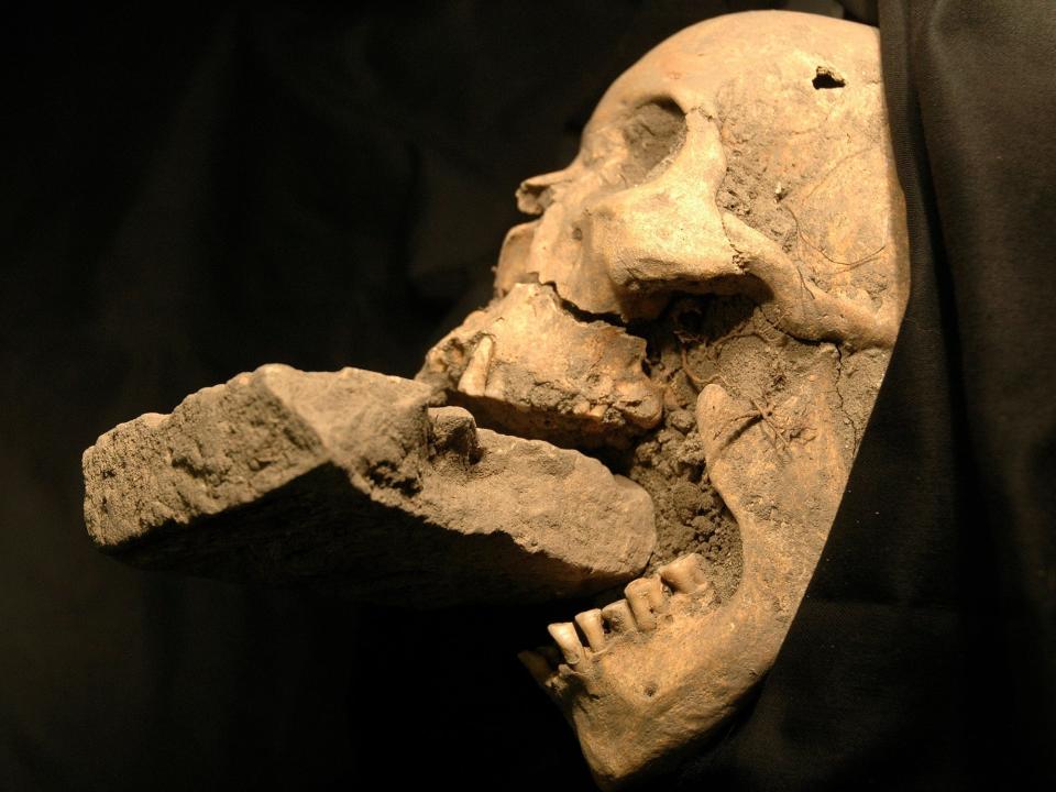 A skull with a dislocated jaw and a stone place in its mouth is shown from the side.