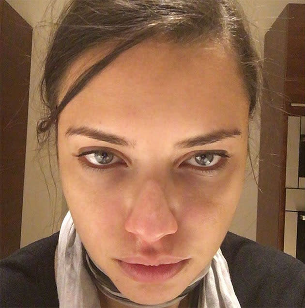 <br><b>Adriana Lima:</b> Supermodel Adriana Lima shared this makeup-free selfie after a long day to prove that it's not all glitz and glamour in the modelling world.<br><br> "This is not a complain, just sharing a little bit of my life," she wrote alongside the snap on Instagram. "Sometimes, people question, that model life is easy, and that's wrong, we work as hard as any other individual. Today I had 10 hours of work day, shooting with a very bad cold, coughing no stop and a massive headache. That did not stopped me on doing what I love."<br><br>"I finished, went to airport, to comeback home to see my 2 princesses. Arriving there, my flight was over 3 hours delayed. I fly from NYC to Miami. Just waked home 2am. Happy to be here. And wanted to share the face of a hard working model, and share that I am not the only one that works this hard. Thank you. And I hope my message don't get misunderstand. Love u all."