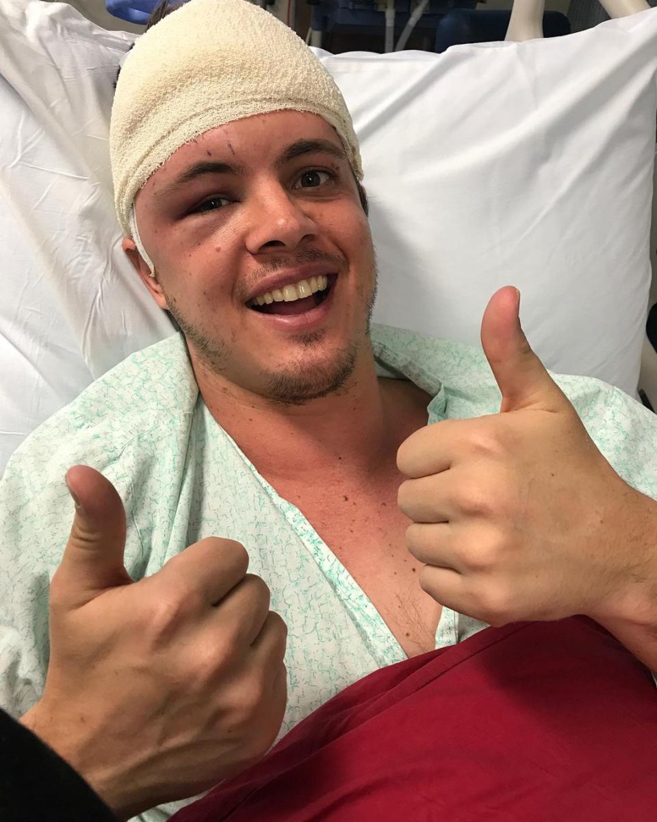 home and away's johnny ruffo fighting brain cancer