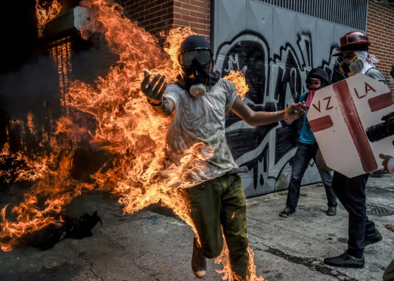 Victor Salazar caught fire after a police motorbike exploded. From his hospital bed where he lay in bandages later, he urged protesters: "Get out into the street, not for me but for Venezuela"