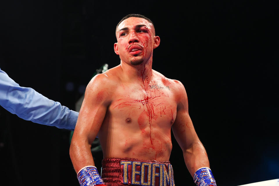 Seen here, Teofimo Lopez during his fight with George Kambosos Jr. for the Undisputed Lightweight title.