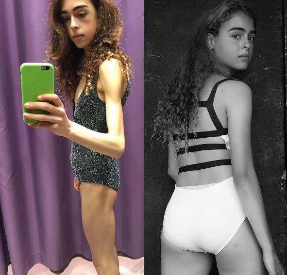 <p>En su peor momento, la británica Margherita Barbieri llegó a pesar 25 kilos (55 libras). Su talento como bailarina comenzó a verse afectado por su régimen alimenticio, pues los profesores solían decirle que su cuerpo era “inaceptable” para bailar. Ahora, como ella misma lo dice, está “reviviendo de las cenizas”. Fotos: Instagram.com/margibarbieri </p>