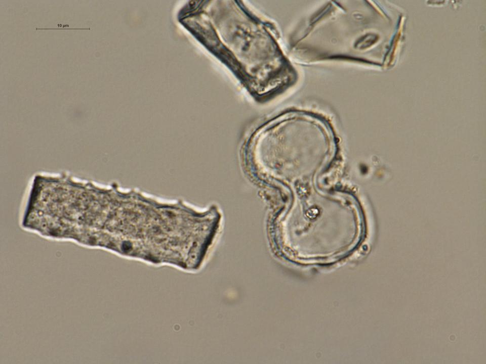 Example of typical grass phytoliths, extracted from paleosol at one of the sites, some of which indicate the presence of C₄ grass. Alice Novello